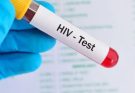 Janjgir Champa Jail HIV Positive